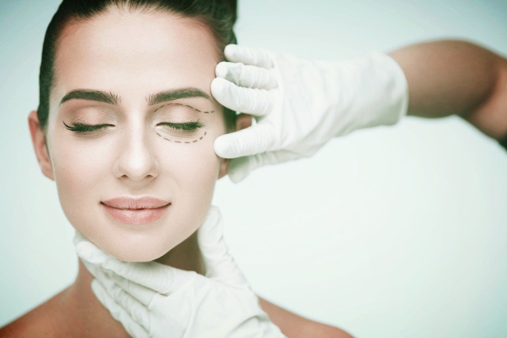 блефаропластика